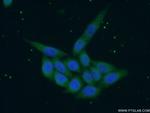 SREBF1 Antibody in Immunocytochemistry (ICC/IF)