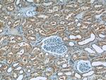 SREBF1 Antibody in Immunohistochemistry (Paraffin) (IHC (P))