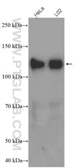 SREBF1 Antibody in Western Blot (WB)