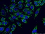 ARHGEF7 Antibody in Immunocytochemistry (ICC/IF)