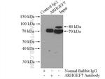 ARHGEF7 Antibody in Immunoprecipitation (IP)