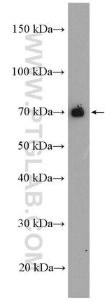 ARHGEF7 Antibody in Western Blot (WB)