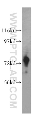 ARHGEF7 Antibody in Western Blot (WB)