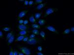 ACBD3 Antibody in Immunocytochemistry (ICC/IF)