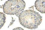 ACBD3 Antibody in Immunohistochemistry (Paraffin) (IHC (P))