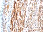 Crystallin Alpha B Antibody in Immunohistochemistry (Paraffin) (IHC (P))