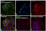 CD104 (Integrin beta 4) Antibody