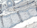 ARNT/HIF1B Antibody in Immunohistochemistry (Paraffin) (IHC (P))