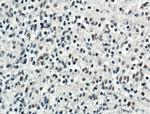 ARNT/HIF1B Antibody in Immunohistochemistry (Paraffin) (IHC (P))