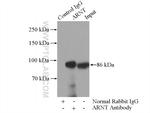 ARNT/HIF1B Antibody in Immunoprecipitation (IP)