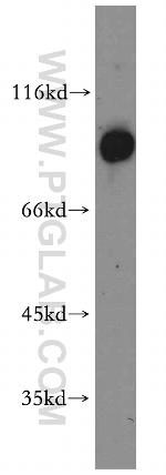 ARNT/HIF1B Antibody in Western Blot (WB)