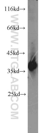 NAPB Antibody in Western Blot (WB)