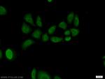 RNF8 Antibody in Immunocytochemistry (ICC/IF)