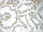 RNF8 Antibody in Immunohistochemistry (Paraffin) (IHC (P))