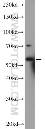 RNF8 Antibody in Western Blot (WB)