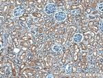 ASPH Antibody in Immunohistochemistry (Paraffin) (IHC (P))