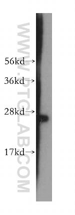 ASPH Antibody in Western Blot (WB)