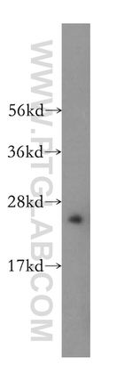 ASPH Antibody in Western Blot (WB)