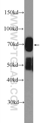 FADS Antibody in Western Blot (WB)