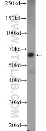 FADS Antibody in Western Blot (WB)