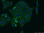 FADS Antibody in Immunocytochemistry (ICC/IF)