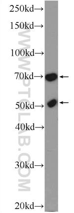 FADS Antibody in Western Blot (WB)