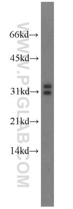 MARCH8 Antibody in Western Blot (WB)