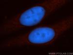 TPPII Antibody in Immunocytochemistry (ICC/IF)