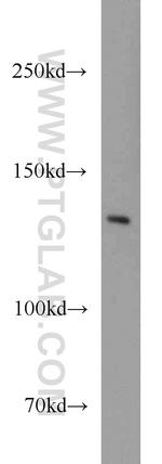 TPPII Antibody in Western Blot (WB)