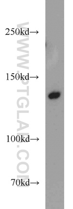 TPPII Antibody in Western Blot (WB)