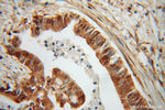 RPS3A Antibody in Immunohistochemistry (Paraffin) (IHC (P))