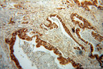 RPS3A Antibody in Immunohistochemistry (Paraffin) (IHC (P))