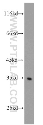 RPS3A Antibody in Western Blot (WB)