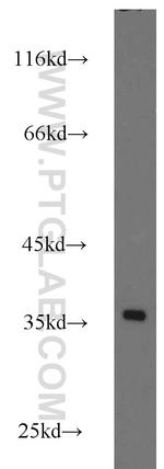 RPS3A Antibody in Western Blot (WB)