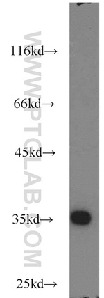 RPS3A Antibody in Western Blot (WB)