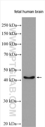 MARCKSL1 Antibody in Western Blot (WB)