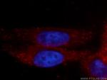 GFPT1 Antibody in Immunocytochemistry (ICC/IF)