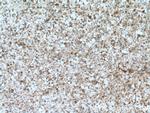 GFPT1 Antibody in Immunohistochemistry (Paraffin) (IHC (P))