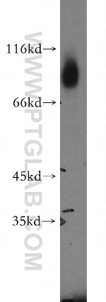 GFPT1 Antibody in Western Blot (WB)