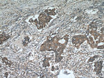 ADAM12 Antibody in Immunohistochemistry (Paraffin) (IHC (P))