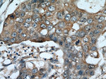 ADAM12 Antibody in Immunohistochemistry (Paraffin) (IHC (P))