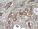 ADAM12 Antibody in Immunohistochemistry (Paraffin) (IHC (P))