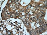 ADAM12 Antibody in Immunohistochemistry (Paraffin) (IHC (P))