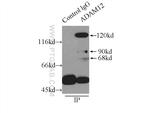 ADAM12 Antibody in Immunoprecipitation (IP)