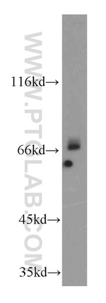 ADAM12 Antibody in Western Blot (WB)