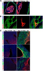 CD140b (PDGFRB) Antibody in Immunohistochemistry (IHC)