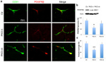 CD140b (PDGFRB) Antibody in Immunohistochemistry (IHC)