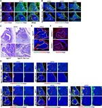 CD140b (PDGFRB) Antibody in Immunohistochemistry (IHC)