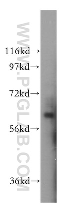 ISYNA1 Antibody in Western Blot (WB)