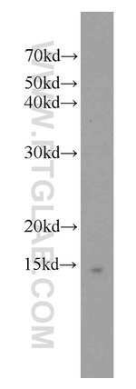 FXN Antibody in Western Blot (WB)